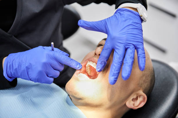 Best Emergency Gum Treatment in Vamo, FL